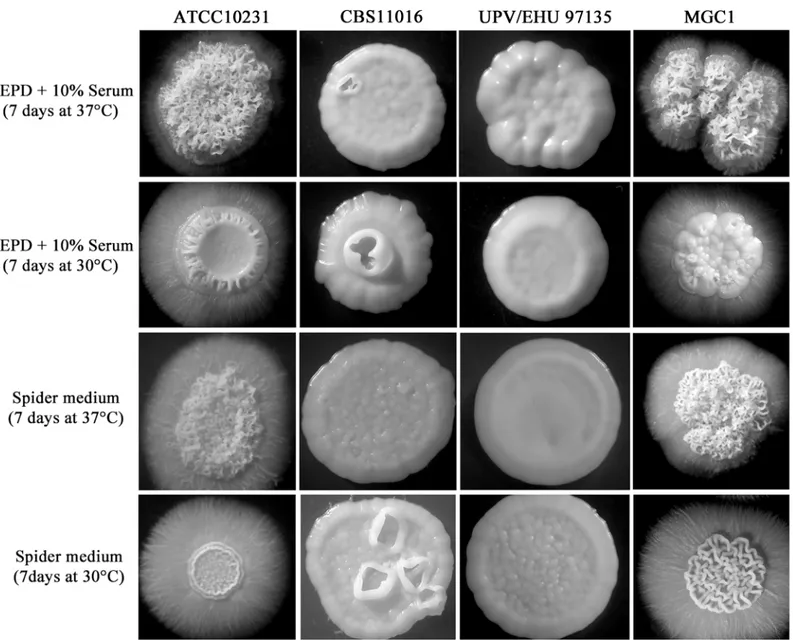 Fig 3. Morphologies of C. albicans and C. africana colonies obtained in this study after 7 days of incubation at 30°C and 37°C on YEPD plus 10% serum and Spider medium.