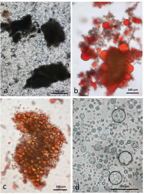 Figure 6. Chewed whole roasted almonds stored in CDTA: (a) multicellular particles of almond tissue surrounded by released lipid drops; (b) lipid drops stained with Sudan IV adhere to the particles; (c) lipid is released from oleosomes during roasting and 