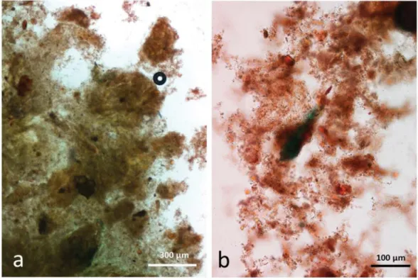 Figure 9. Faecal sample stained with Sudan IV from control diet, no almonds eaten, (a,b) faeces contain plant remains in a background of micro-organisms and mucin.