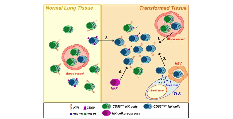FiGUre 1 | Natural killer (NK) cell subsets in healthy and neoplastic lung tissues. Human healthy lung tissues are mainly populated by CD56 dim CD16 +