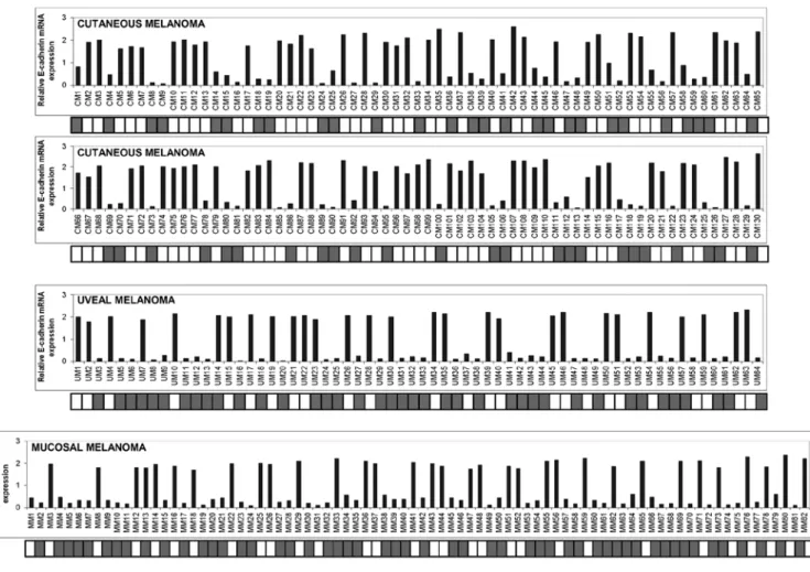 Figure 1. Expression levels and the methylation status of E-cadherin in cutaneous, uveal and mucosal melanoma specimens