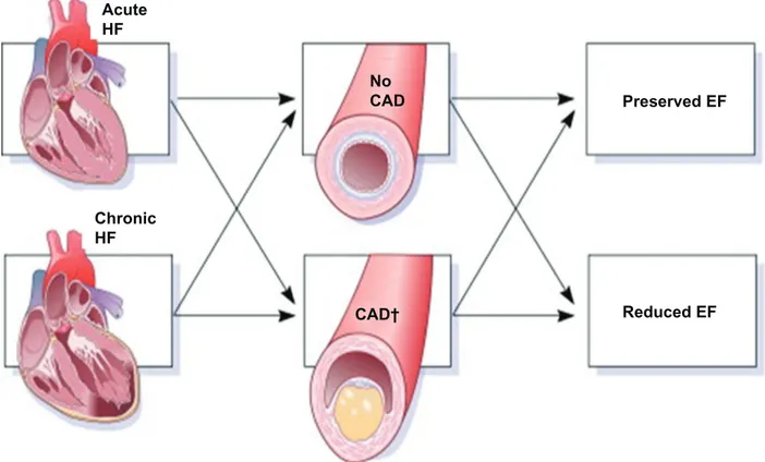 Figure 1 Classification of acute and chronic heart failure on the basis of coronary diseases and systolic dysfunction presence.