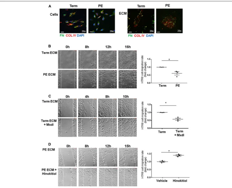FIGURE 7 | Defects in ECM deposited by PE pMSCs impedes extravillous trophoblast cell migration in vitro