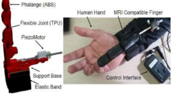 Fig. 1. 3D printed MRI compatible finger having flexible material (TPU) as flexible joints and stiff (ABS) material acting as rigid links