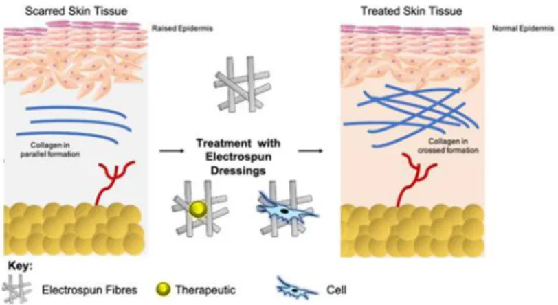 Figure  7.  General  schematic  of  wound  healing  scar.  Source:  Mulholland  EJ  (2020)  Electrospun  Biomaterials  in  the  Treatment  and  Prevention  of  Scars  in  Skin  Wound  Healing