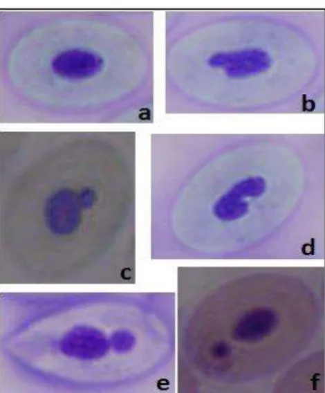 Figura 9 Nucleo normale di eritrocita di pesce (a), nucleo lobato (b, c), kidney (d), segmentato (e) e micronucleo (f)