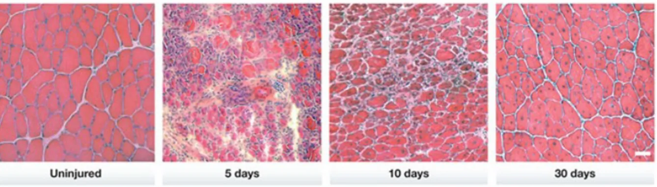 Figure  10.  Overview  of  tissue  histology  during  mouse  skeletal  muscle  regeneration