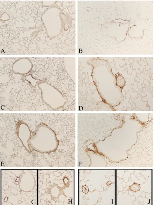 Figure 8. Representative pulmonary sections stained for α-SMA. (A) and (B) Tissue sections from  C57 Bl/6J and DBA/2 control mice exposed to room air
