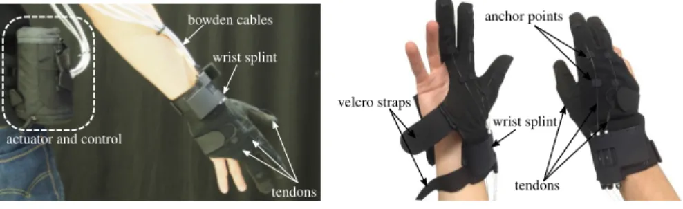 Figure 1.4: Soft glove for grasping assistance; dorsal and palmar view. The glove combines three different fabrics and rigid anchor points to be both comfortable and functional