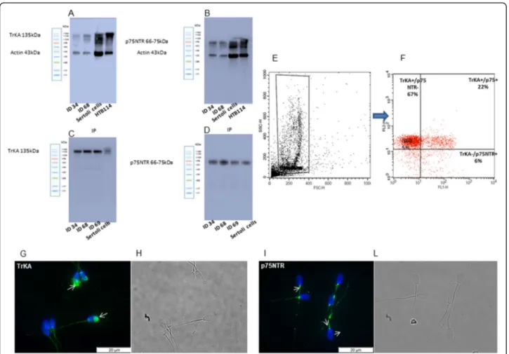 Fig. 1 Protein expression and localization of TrKA and p75NTR receptors in ejaculated rabbit sperm