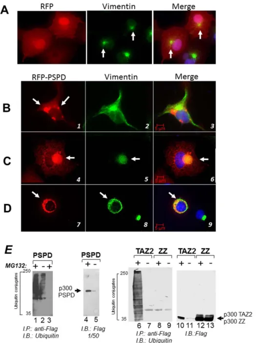 Figure 6. The p300 PSPD is sufficient for aggresome localization. A–D. Cell transfected with the vector expressing RFP alone and treated with MG132 (panel A), or transfected with the RFP-PSPD (panels B–D) were mock treated (B), or treated with MG132 (C–D) 