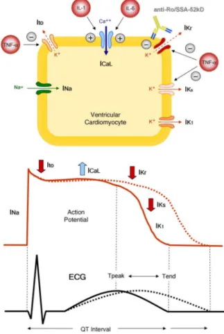 Figure 1 QT interval, inflammation and autoimmunity. From the cell to the surface ECG