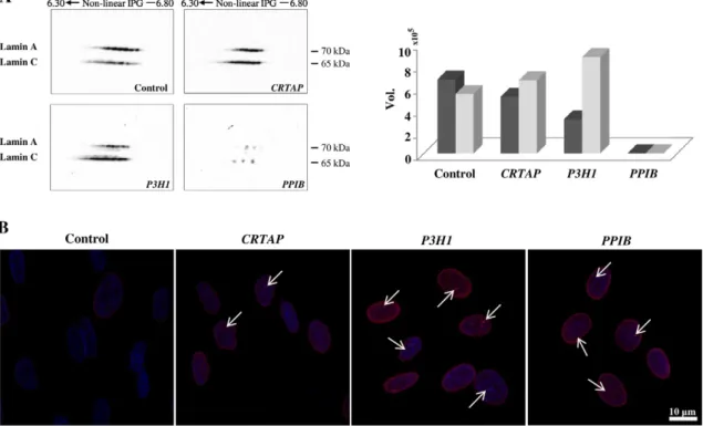 Fig. 5. Lamin A/C protein abundance (A) and nuclear organization in human dermal ﬁbroblasts from control subjects and OI patients with mutations in CRTAP, P3H1, and PPIB genes (B)