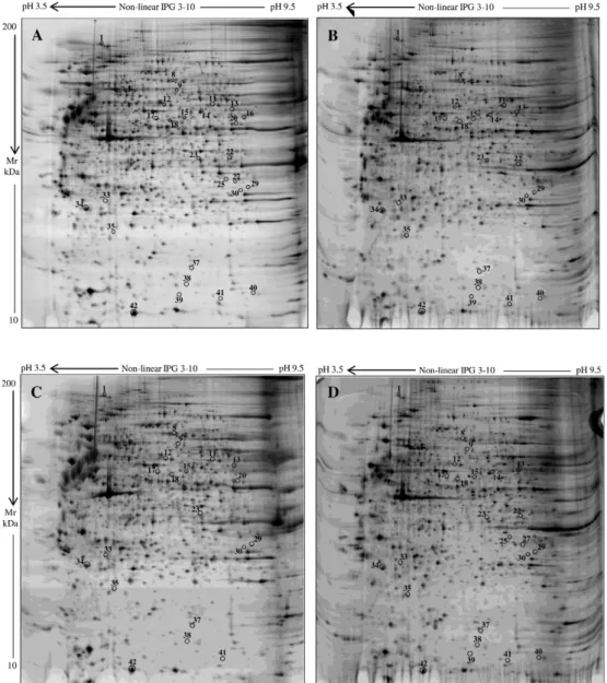 Fig. 1. Silver stained electropherograms of ﬁbroblasts from control (A), CRTAP (B), P3H1 (C), and PPIB (D) subjects