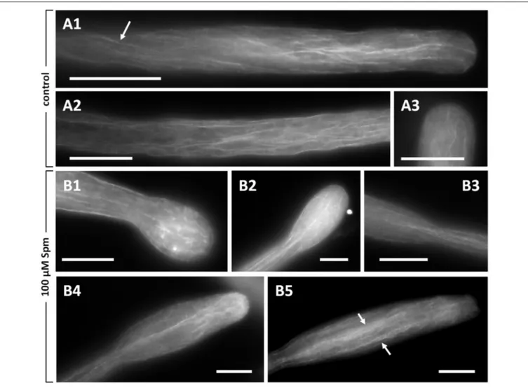 FIGURE 5 | Distribution of actin filaments in pear pollen tubes. (A1,A2) Control pollen tubes