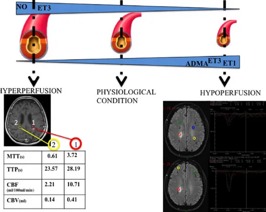 Figure 3.  BBB and stroke pathophysiology. In different phases (early or late) of ischemic stroke, the same biochemical factors have opposite roles: 