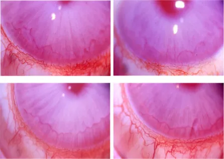 Figure 5. Images of implanted rabbit corneas. The ready to use solution of Bioexpander ®  was 