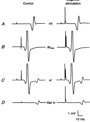 Figure 2 illustrates the time course of cortical action on the reference H reflex (triangles) and on the H' reflex (circles) of the soleus muscle from three subjects
