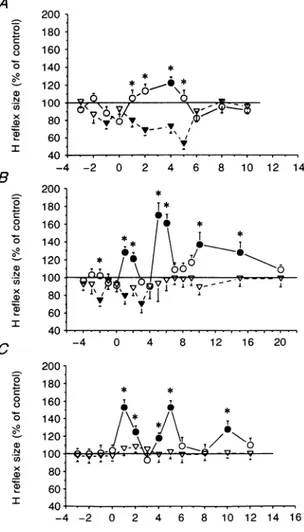Figure 2. The effect of magnetic brain stimulation on the size of the soleus H' and reference H reflexes at rest in three different subjects