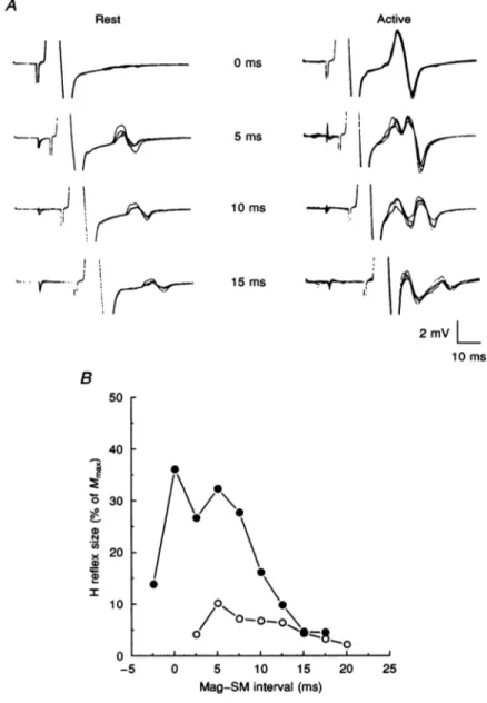 Figure 3. Comparison of ADM H reflex variations with different Mag-SM intervals under resting and active conditions