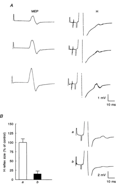 Figure 5. Effect of a conditioning ulnar nerve stimulus on the H reflex of the relaxed ADM muscle