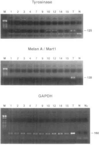 Figure 1), peripheral blood sample was obtained (after a written informed consent) and RT-PCR was performed