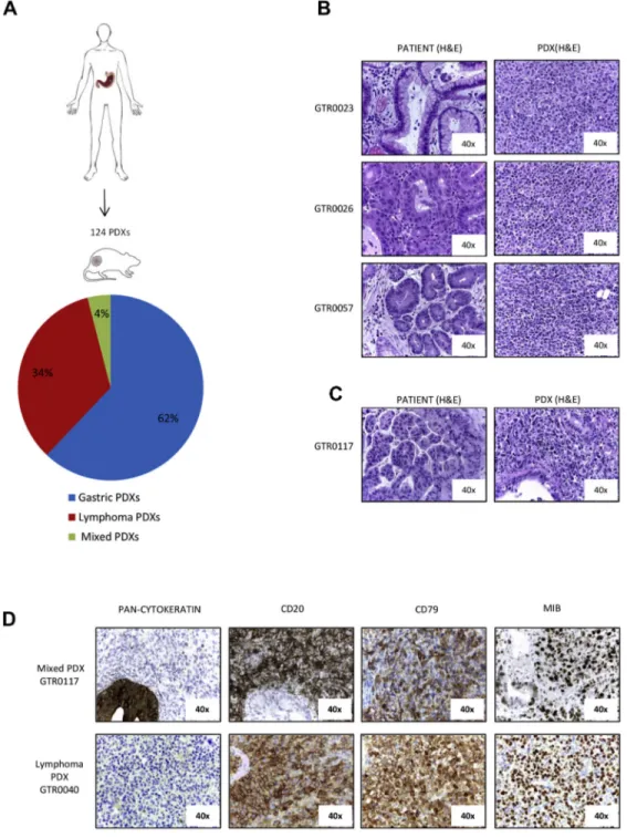 Figure 1. B-cell lymphomas originate from gastro-esophageal adenocarcinomas implanted in NOD/SCID mice