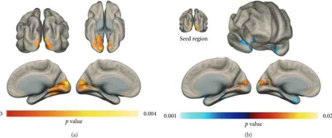 Figure 1: Voxel-wise FC changes. An increase in resting-state voxel-to-brain connectivity was observed in the occipital lobe of PI patients with respect to healthy controls