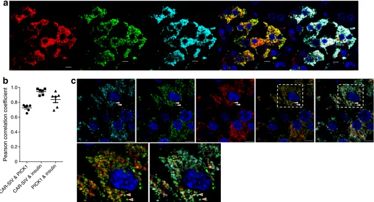 Fig. 6 CAR-SIV co-localisation with PICK1 in the beta cell. (a) Representative immunofluorescence staining of PICK1 (red), CAR-SIV isoform (CAR-CT antibody; green), insulin (light blue) and DAPI (dark blue) in non-diabetic human pancreas