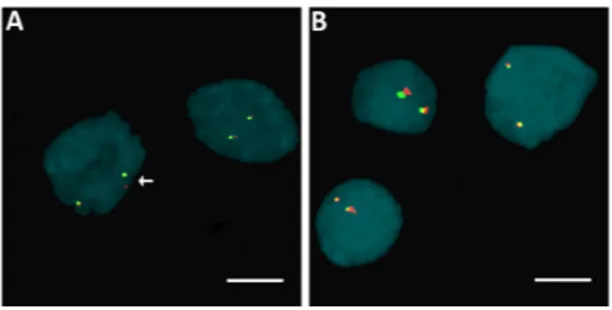 Figure 2. Examples of fluorescence in situ hybridization (FISH) in isolated nuclei for the 