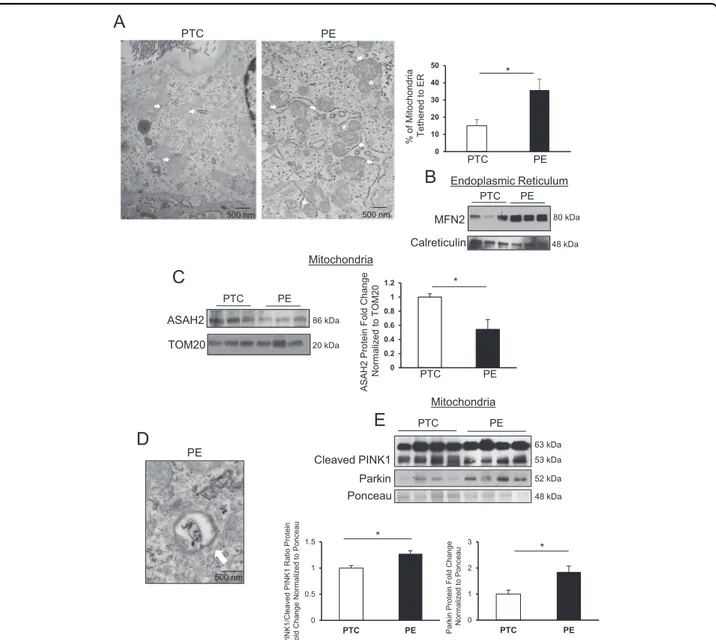 Fig. 8 Mitophagy contributes to removal of excess mitochondrial fragments in preeclampsia