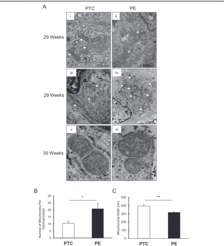 Fig. 2 Preeclampsia is associated with mitochondrial ﬁssion morphology in cytotrophoblast cell