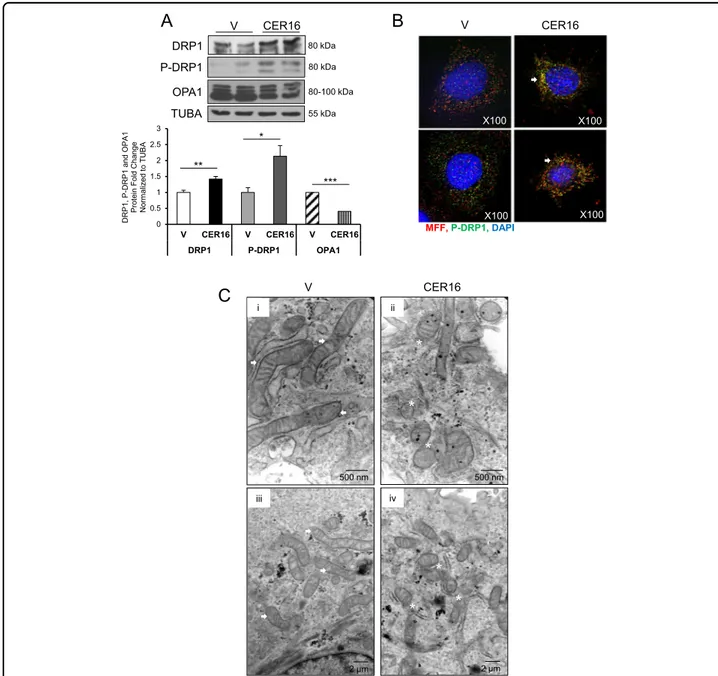 Fig. 4 Ceramide induces mitochondrial ﬁssion in primary isolated trophoblast cells. a Representative western blots of DRP1, p-DRP1, and OPA1 and associated densitometry in primary isolated cytotrophoblast cells treated with CER 16:0 or EtOH vehicle (V) (n 