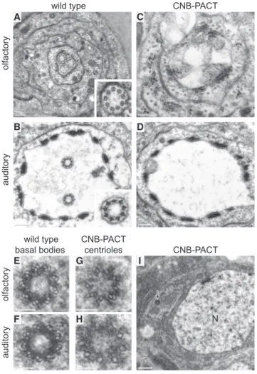 Figure 2. Pancentriolar CNB Localization Inhibits Axoneme Assem- Assem-bly in Type I Neurons