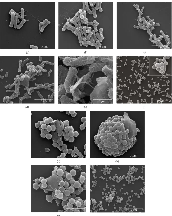Figure 9: SEM micrographs of antibacterial eﬀect of GO and GO