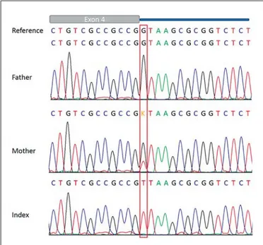 Fig. 6.   Electropherograms showing the  SCARF2  c.854 + 1G 1 T  (intron 4) splice acceptor mutation hemizygous in the patient  (in-dex) and heterozygous in the healthy mother