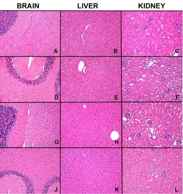 Figure 8. The figure shows representative microscopic pictures (200× magnification) of kidney, liver  and central nervous system tissues of untreated mice (A–C); mice treated with only vehicle (D–F);  mice treated with dose level of 50 mg/kg of Si306 (G–I)