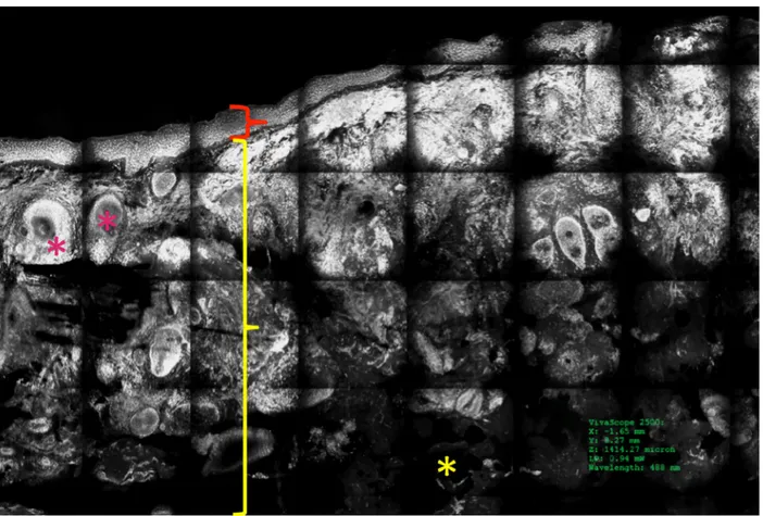 Figure 2. Normal skin under ex vivo confocal microscope in fluorescence mode with acridine orange