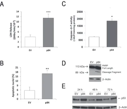 Fig 2. hMp84 stimulates cell death and stabilizes p53 protein in A375 melanoma cells. At 24 h after transfection, cell death was evaluated in EV-cells and in p84-cells as amount of intracellular LDH released in the culture medium (A), as percentage of nucl