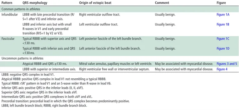 Table 2  Morphology and characteristics of premature ventricular beats that may be encountered in clinical practice