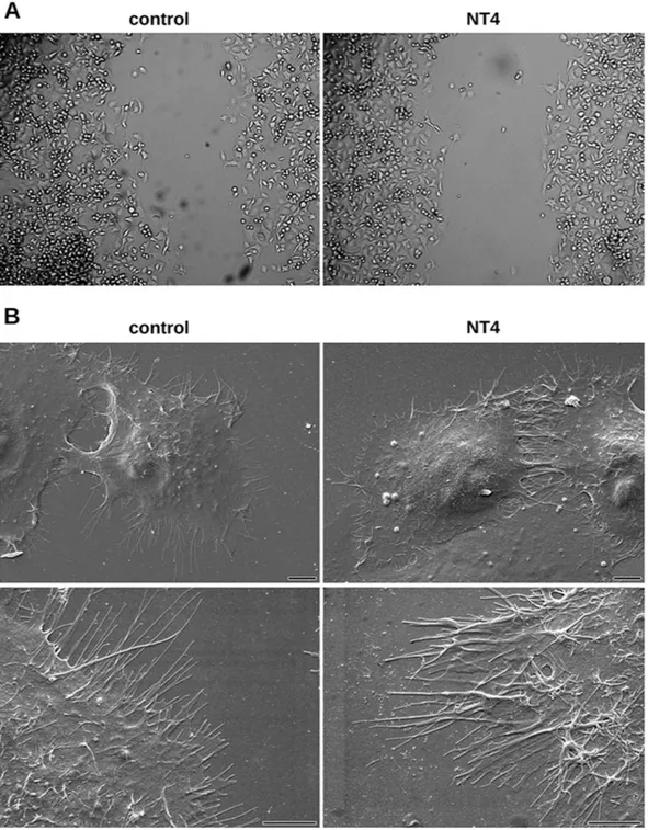 Figure 6.  Cancer cell morphology of PANC-1 in control wells (left panels) and in the presence of 10 μ M 
