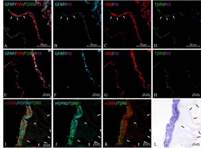 FIGURE 2. T βRII expression in iERMs. (A–D) Because of the ERM folding, confocal microscopy shows ERM cells arranged in two rows and
