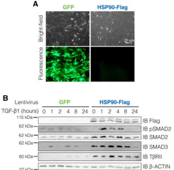 FIGURE 5. HSP90 enhances SMAD2, SMAD3, and T βRII expres-