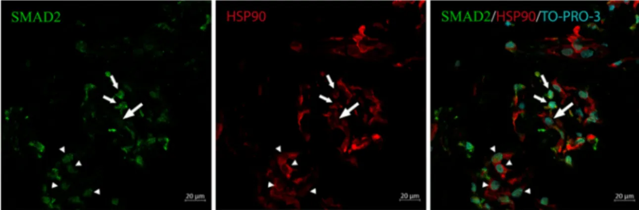 FIGURE 6. SMAD2 translocation to the nucleus of iERM cells. Frozen sections were immunostained with anti-SMAD2 and anti-HSP90 α