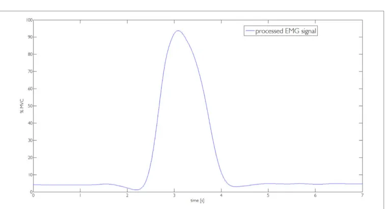 FigUre 14 | raw eMg signal captured by the one channel interface during the execution of the task reported in Figure 8a.