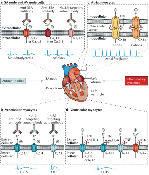 Fig. 1 |  Autoimmune and inflammatory cardiac  channelopathies and arrhythmias: molecular  basis
