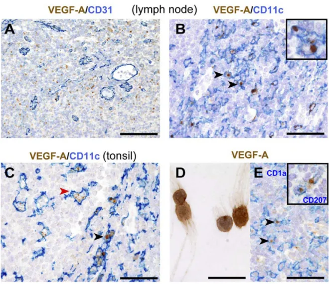 Figure 1: distribution and phenotype of VeGF-A-producing cells in human reactive lymphoid tissues