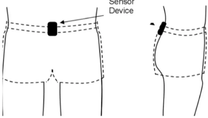 Figure 1. Wearable device on a belt, positioned at the sacrum. 