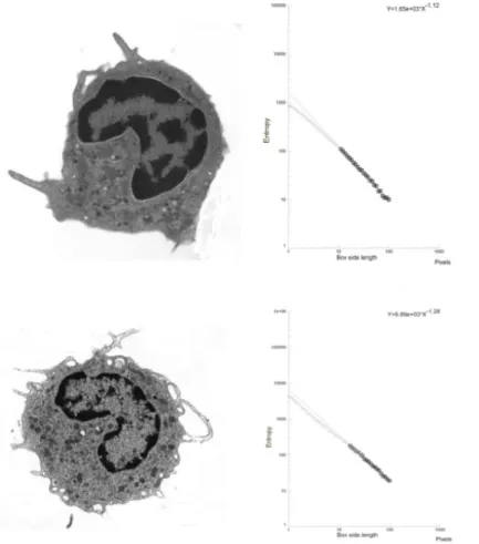 Figure 4: A monocyte (transmission electron microscopy, x 3700) in a healthy subject (top) and in type 2 diabetes mellitus (below)