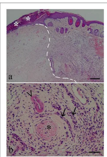 FIGURE 5 | Skin photomicrographs from a male given β-caryophyllene 5 mg/kg (BCP5). (a) Low magnification (×40) showing the formalin injection site (left of the dotted line) and the inflammatory response area